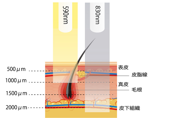 医療用LED治療器 ヒーライトIIとは